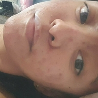 xsugarvulpesx Naakt